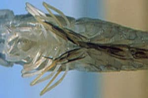 Fig. 5 Pleopodos melanizados por causa de una necrosis.