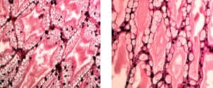 Fig. 6 Grados de vacuolización lipídica en túbulos del hepatopancreas. Lado izquierdo muestra un grado alto. Lado derecho con grado bajo. (100X . Van de Braak et al, 2012).